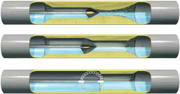 Ein Bild der Elektromechanischen Rohrreinigung vom Sanitär Notdienst Hamburg